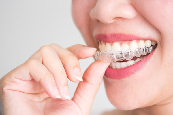 ortodoncia Invisalign en Portugalete