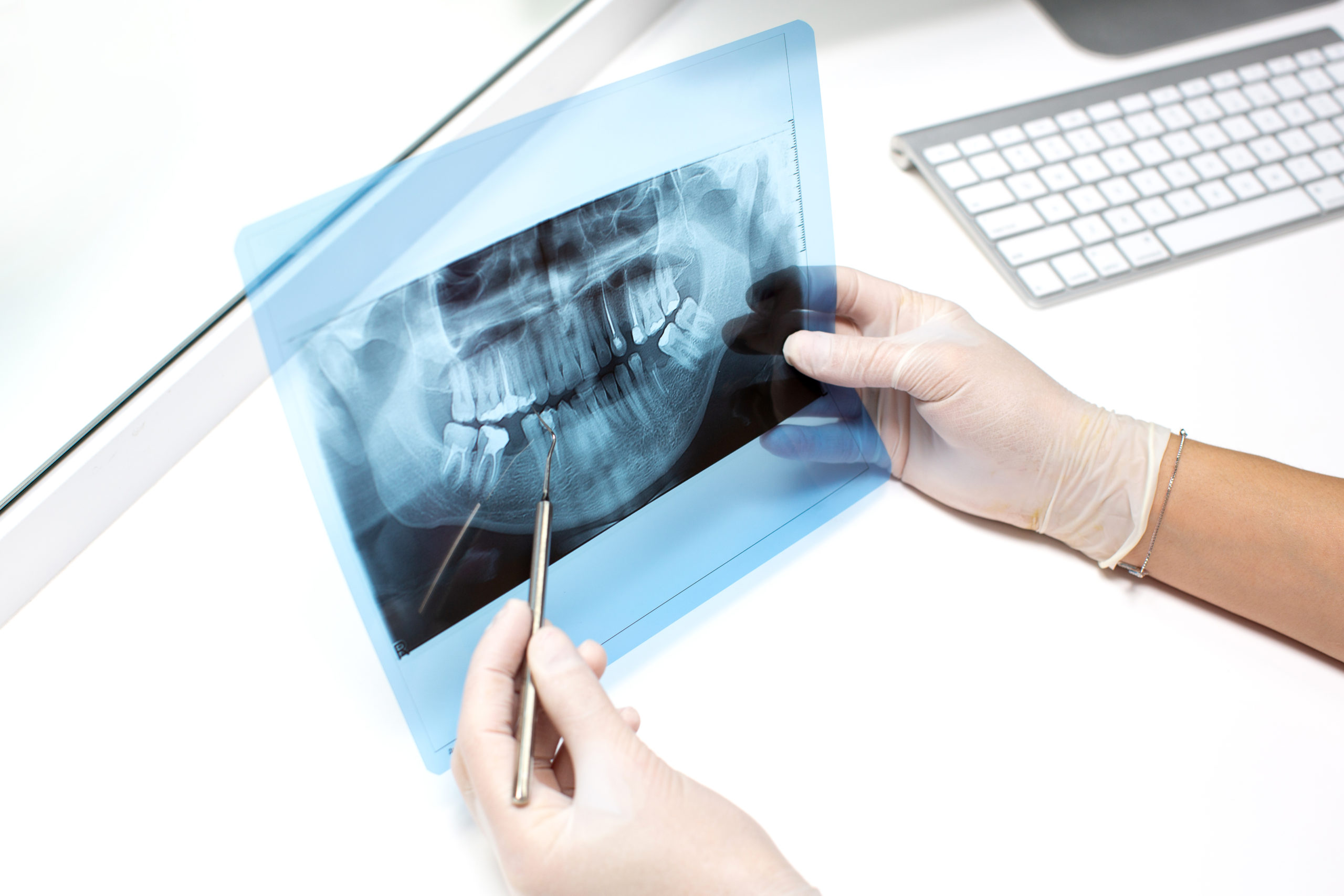 qué se ve en una radiografía dental