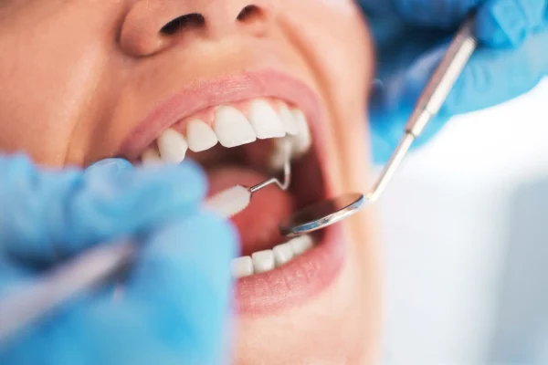 La importancia de las revisiones dentales revision dental en portugalete
